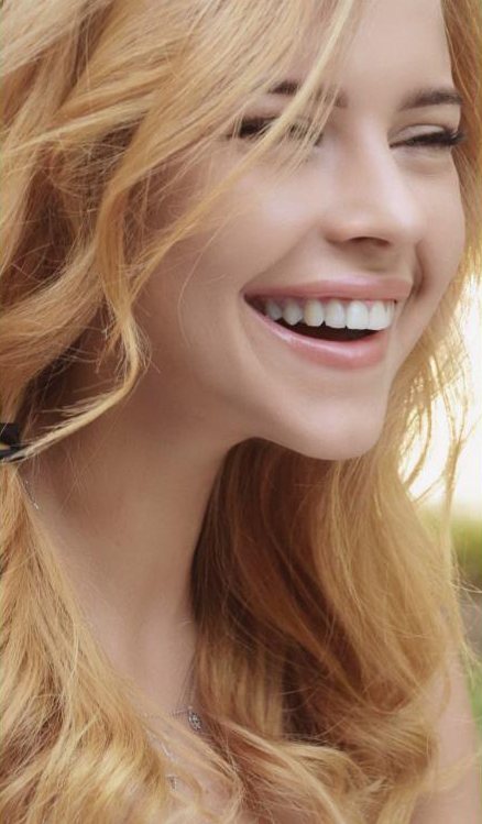 Sourire éclatant après un blanchiment dentaire