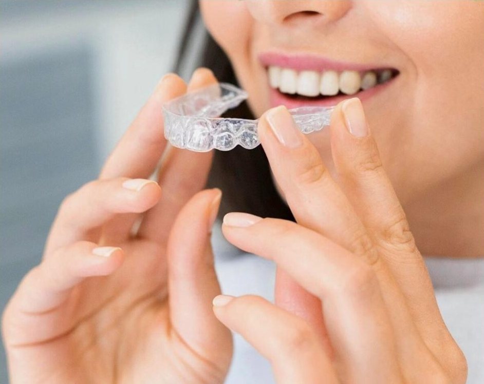 Orthodontie enfant & adulte — Espace Dentaire de Bessancourt